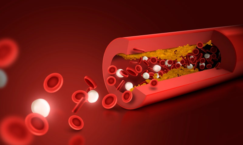쏜 리서치 모듀 케어