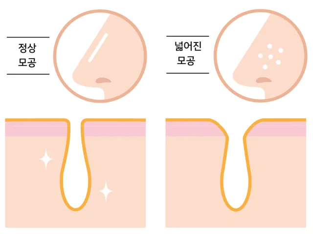 모공 탄력