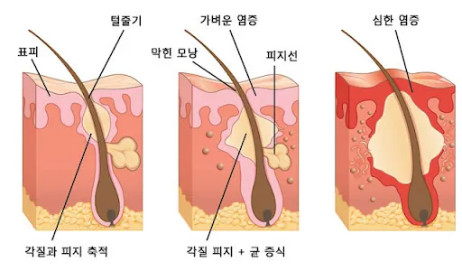 여름 세안